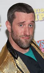 Dustin Diamond